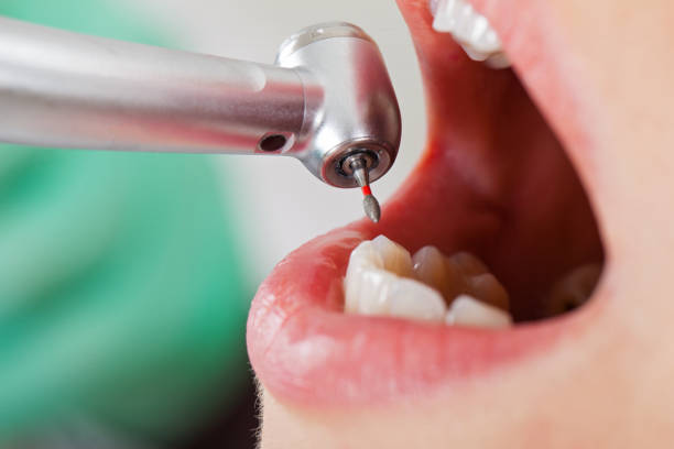 Best Weekend Emergency Dentist in New Castle, CO